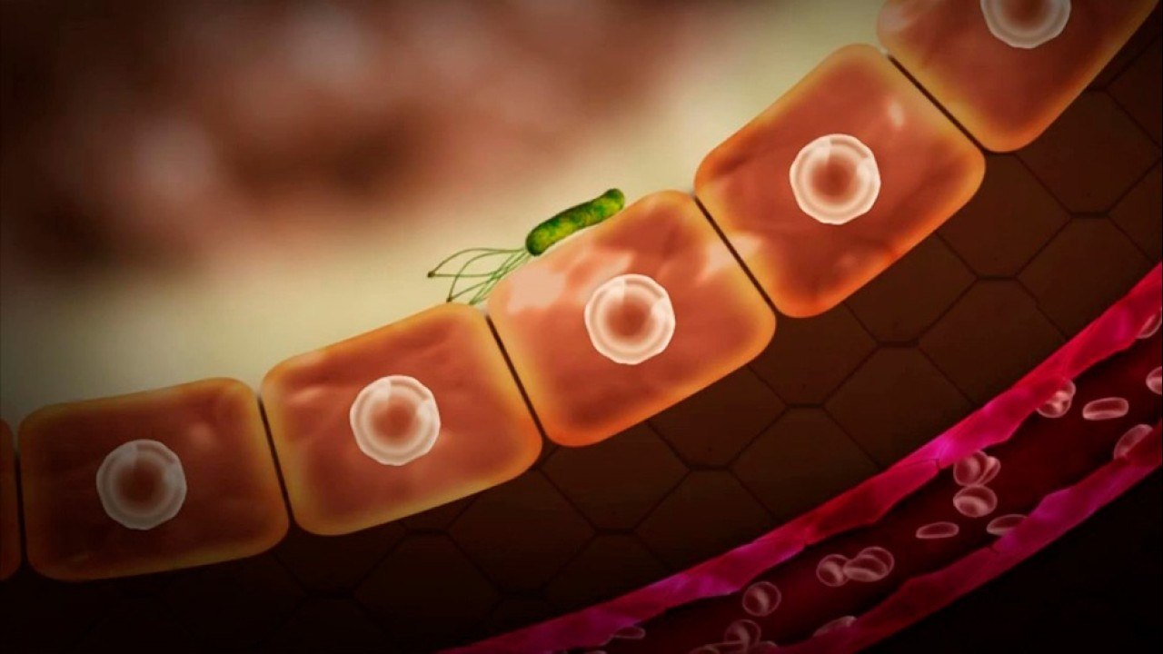 bd-bacteria-helicobacter-pilory-causas-sintomas-y-tratamientos-131021