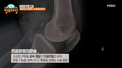 [다시 걷는 행복] 찢어진 연골판, 수술 결과는?
