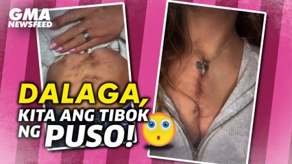 Dalaga, kita ang tibok ng puso! | GMA News Feed