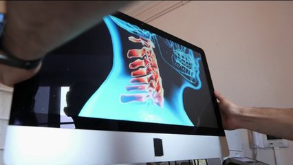 Santé - Cervicales : attention fragile !
