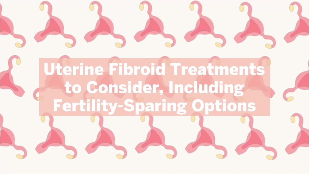 10 Uterine Fibroid Treatments to Consider, Including Fertility-Sparing Options