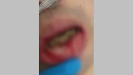 [제보는Y] 요양병원 입원환자 폭행 흔적..."CCTV 없어 오리무중" / YTN