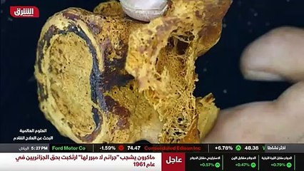 ...تمد على العلاج الكيميائي او العلاج المنا...