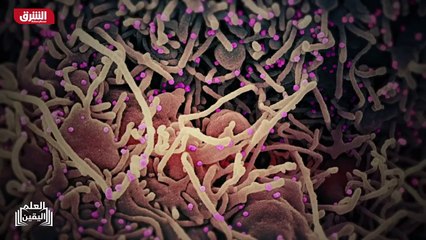 ...واحد منها على سبيل المثال هو فيروس نقص ا...