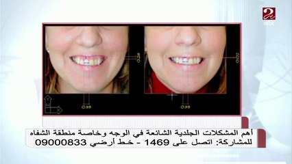 مشاكل شائعة في منطقة الشفاة والفم يعقب عليها د. عاصم فرج