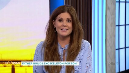 Dad builds exoskeleton for son with neurological condition