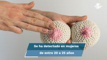 UNAM: El cáncer de mama se presenta en mujeres cada vez más jóvenes