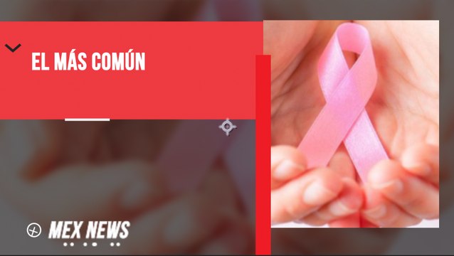 EL CÁNCER DE MAMA ES EL TIPO DE CÁNCER MÁS COMÚN