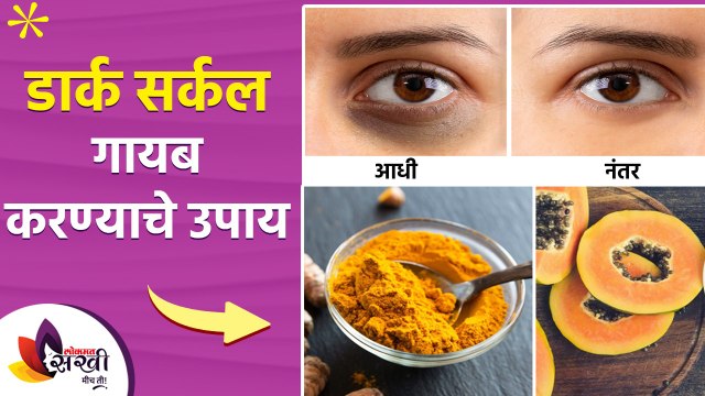 Dark Circles कायमस्वरूपी घालवण्यासाठी ३ घरगुती उपाय | Get Rid Of Dark Circles |Dark Circle Treatment