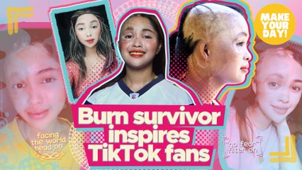Burn survivor inspires TikTok fans | Make Your Day
