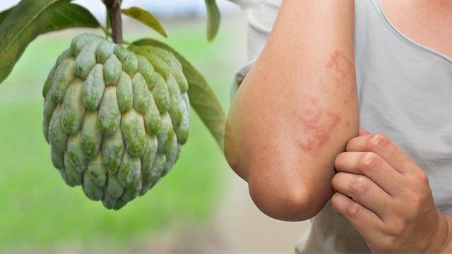 शरीफा खाना हो सकता है खतरनाक, इन लोगों की हालत हो सकती है खराब | Boldsky