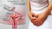 Uterus में गांठ होने के Symptoms चौंका देंगे | Uterus mei gaanth kyu hoti hai ? | Boldsky