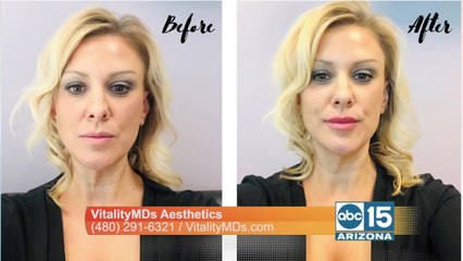 You can look amazing with injectable treatments offered at VitalityMDs Aesthetics