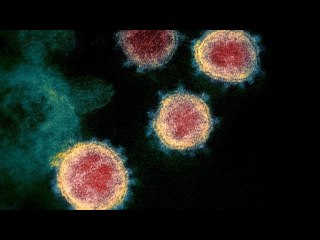 New “Delta Plus” OffShoot Called AY 4 2 May Be Most Infectious Covid