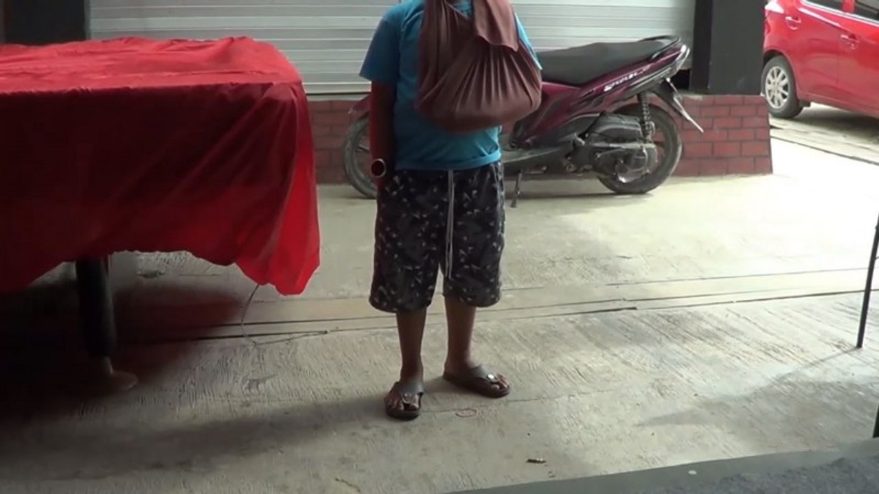 Oknum Anggota Polisi Aniaya Bocah di Mamasa hingga Patah Tulang