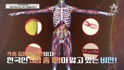 [예고] '나는 왜 비만일까?' 원인을 찾고 만성 염증으로부터 탈출하는 법
