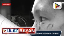 Ginang sa Tondo, Manila, binugbog ng kanyang lasing na kapitbahay