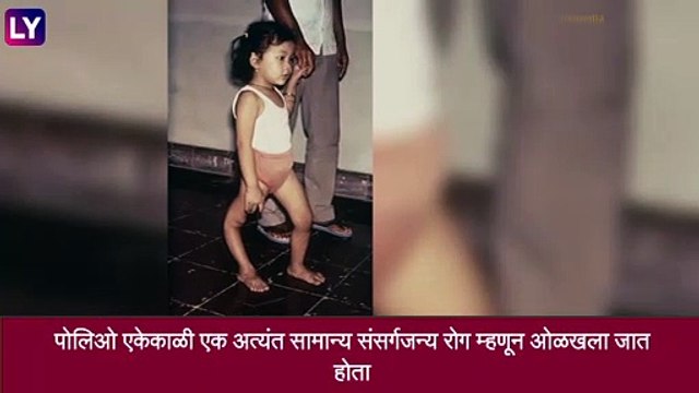 World Polio Day 2021: जागतिक पोलिओ दिवस का साजरा केला जातो? जाणून घ्या या दिवसाची माहिती