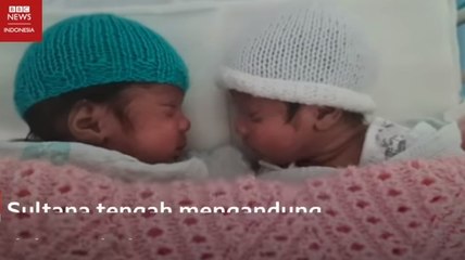 'Anak kembar saya lahir saat saya dalam keadaan koma'