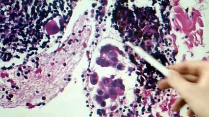 Documentaire Voyage au coeur de nos cellules - Nom de code - PROTEOME .