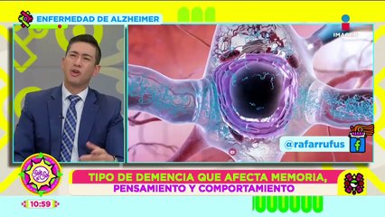 Alzheimer: Síntomas, tratamiento, características y más | Visita de Doctor | Sale el Sol
