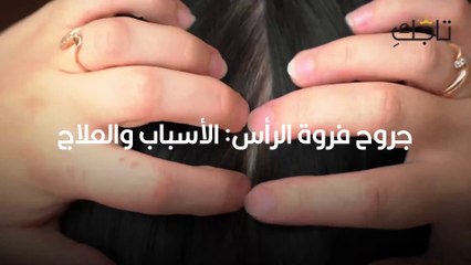 جروح فروة الرأس