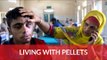 Kashmir’s Pellet Victims Welfare Trust is trying to help victims