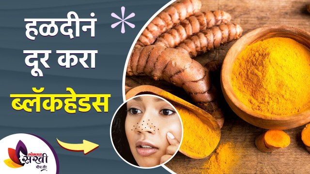 हळदीने ब्लॅकहेड्स करा दूर | Home Remedies for Blackheads | Remove Blackheads Naturally | DIY