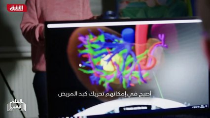 ...ب أن تأتي في غضون بضعة أجزاء من الألف من...