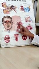 तीन वर्ष के बच्चे की नाक में फंसा मेटल का स्क्रू दूरबीन से निकाला