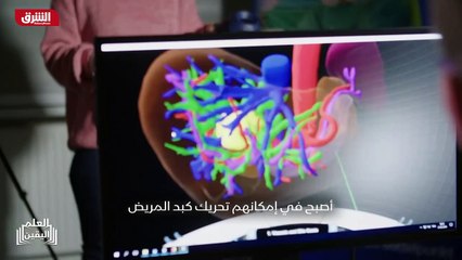 ...تأتي في غضون بضعة أجزاء من الألف من الثا...