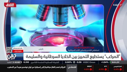 ...أنواع متعددة من السرطانات ومنها سرطانات ...