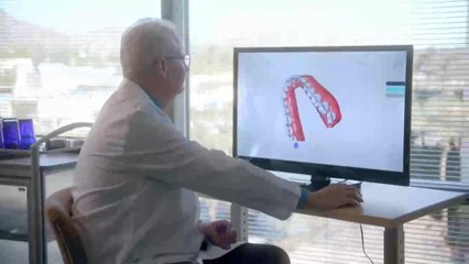 Alineadores impresos 3D llegan a teleodontología para romper brecha económica