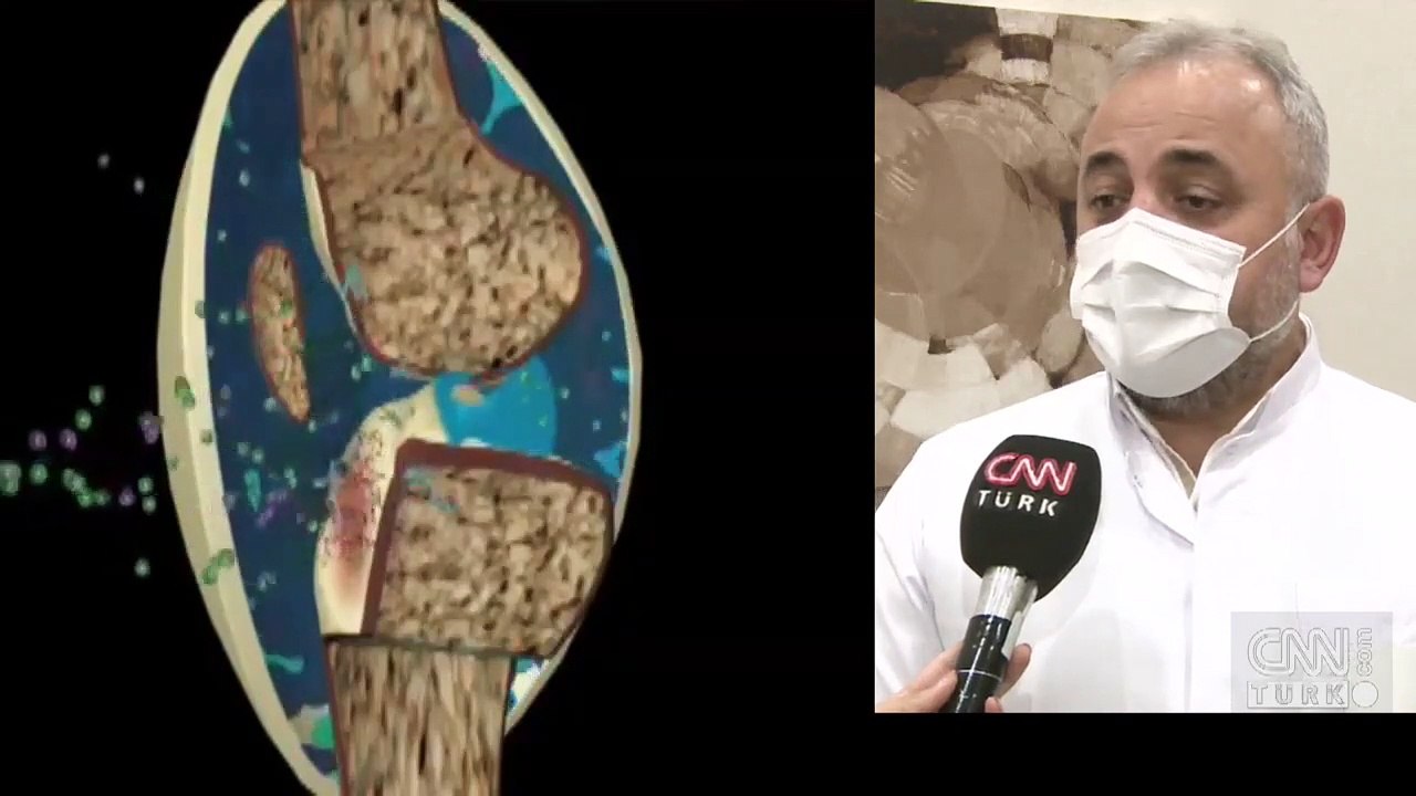 İltihaplı romatizma erken fark edilmeli