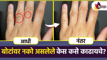 ५ मिनिटांत काढा बोटांवरचे केस | Remove Hair from Fingers in Just 5 Minutes | Lokmat Sakhi