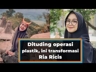 Dituding operasi plastik, ini transformasi Ria Ricis dari chubby hingga dagu lancip