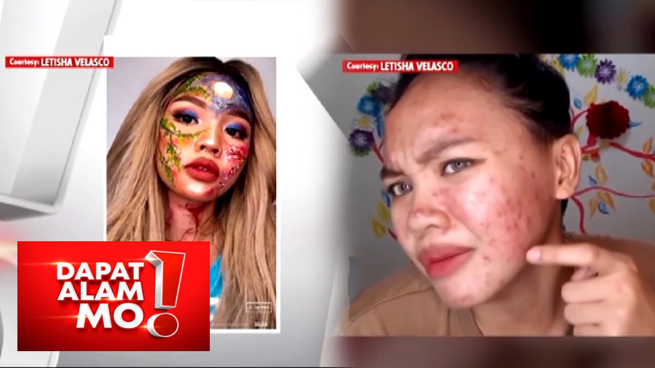 Dapat Alam Mo!: Breakouts at acne, paano maiiwasan?