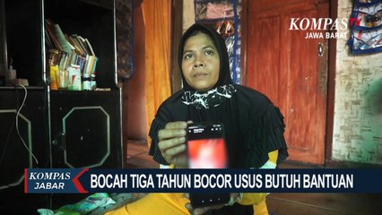 Yuk Bantu! Bocah Bocor Usus Di Kab. Bandung