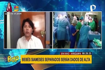 Arequipa: bebés siameses separados tras compleja operación serán dados de alta