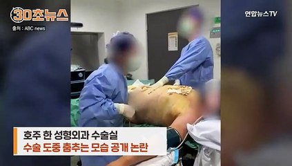 [30초뉴스] 지방흡입 수술 중 춤추는 호주 의사들 논란