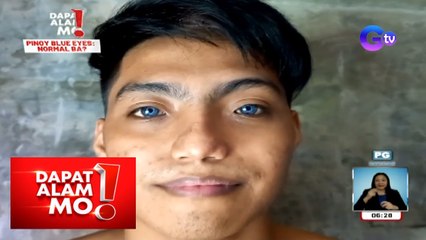 Dapat Alam Mo!: Ilang Pinoy, biniyayaan ng blue eyes?!