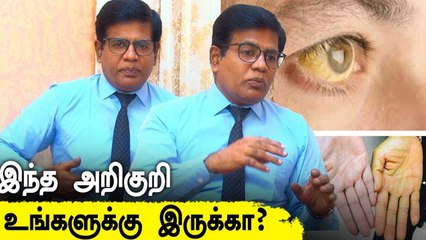 மஞ்சள் காமாலை: அறிகுறிகள், வகைகள், தீர்வுகள் | Dr.Boopathi John | Oneindia Tamil