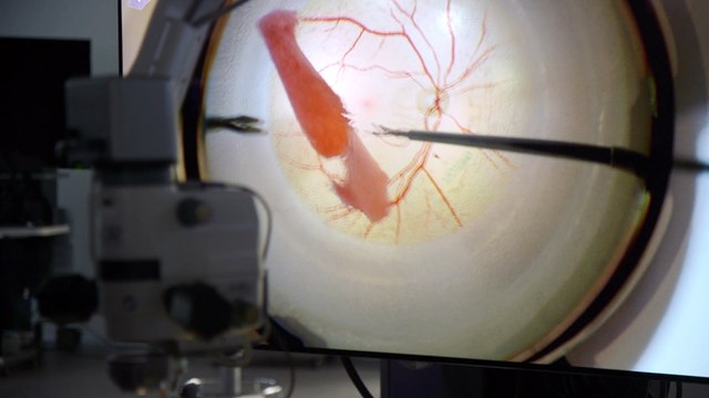 Alcon inaugura en Barcelona su mayor centro europeo de formación en cirugía ocular