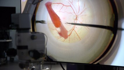Alcon inaugura en Barcelona su mayor centro europeo de formación en cirugía ocular
