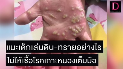 หมอแนะเด็กเล่นดิน-ทรายอย่างไร ไม่ให้หนองเต็มมือ | เดลิ[HOT]นิวส์ 03/11/64
