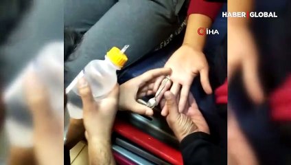 Madeni paradan yaptığı yüzük hastanelik etti