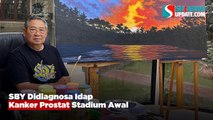 SBY Didiagnosa Idap Kanker Prostat Stadium Awal