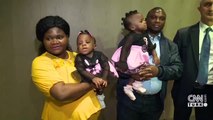 Kamerunlu yapışık ikizler ayrıldı