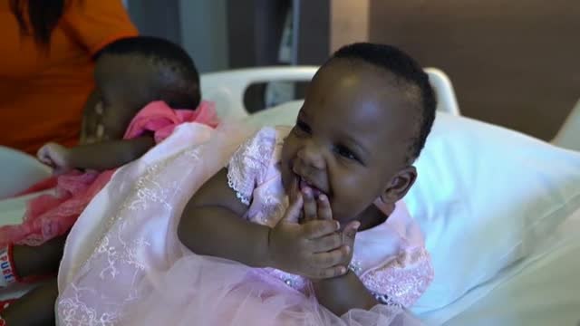 Separan con éxito a las siamesas de Camerún unidas por la columna vertebral y la cadera