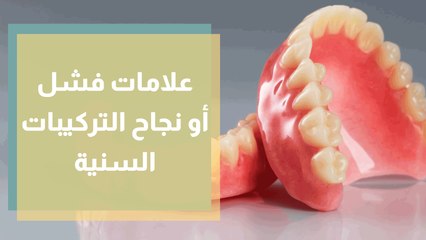 علامات فشل أو نجاح التركيبات السنية